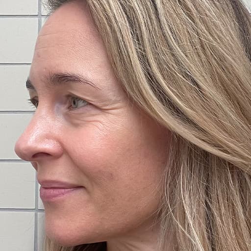 Bilde av Charlotte før hun begynte med The Solution
