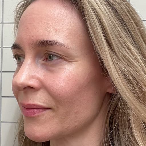 Bilde av Charlotte etter at hun har tatt The Solution i 8 uker, mindre rynker rundt øynene